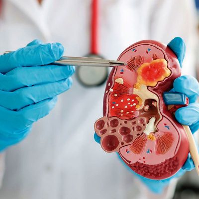 Nefrologia veterinaria